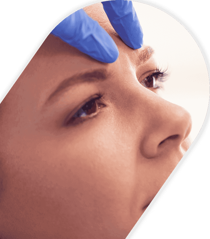 Facial Reshaping Sculpting Botox Cosmetic